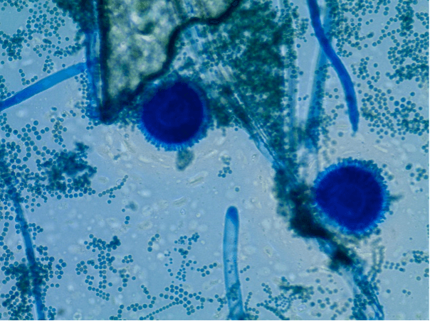 Aspergillus flavus