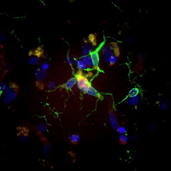 Alzheimer's Research