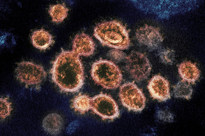 Representative image of Novel Coronavirus SARS-CoV-2, Photo Source: NIH Image gallery (PDM 1.0)