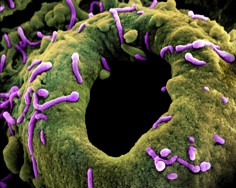 Representative Image. Marburg Virus Particles. Photo Source: NIAID (CC BY 2.0)