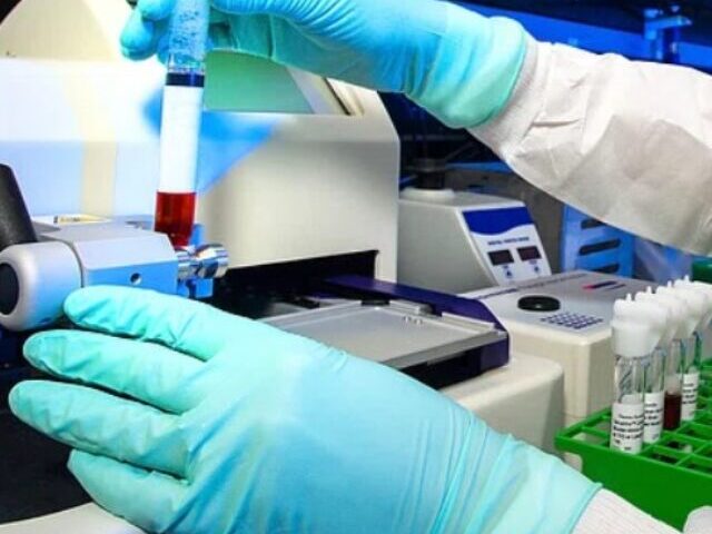 Representative Image: Scientist in a lab coat and gloves operating a piece of laboratory equipment. Photo Source: Rawpixel