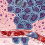 Representative Image Cancer cells illustration, Photo Source: NIH Image Gall