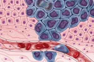 Representative Image Cancer cells illustration, Photo Source: NIH Image Gall