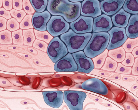 Representative Image Cancer cells illustration, Photo Source: NIH Image Gall