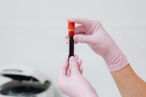 Representative Image Holding a Glass Test Tube, Photo Source: Kaboompics.com