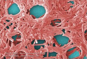 Representative Image Legionella pneumophila, Photo Source: Itoldya