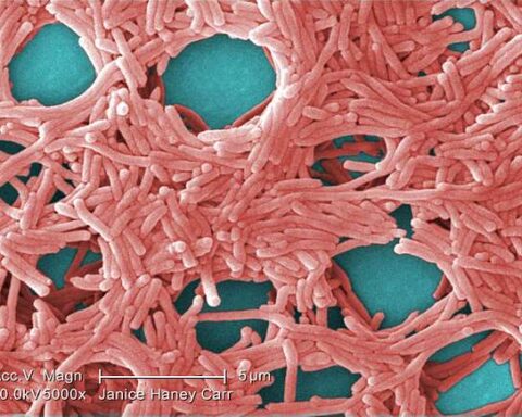 Representative Image Legionella pneumophila, Photo Source: Itoldya