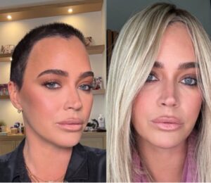 A side-by-side comparison of a woman with two different hairstyles—one with a buzz cut and the other with long blonde hair. Photo Source: teddimellencamp (Instagram)