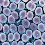 Scanning electron micrograph of Neisseria gonorrhoeae bacteria, which causes gonorrhea. Photo Source: NIAID (CC BY 2.0)