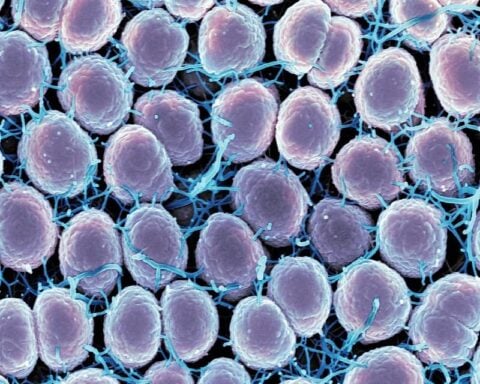 Scanning electron micrograph of Neisseria gonorrhoeae bacteria, which causes gonorrhea. Photo Source: NIAID (CC BY 2.0)