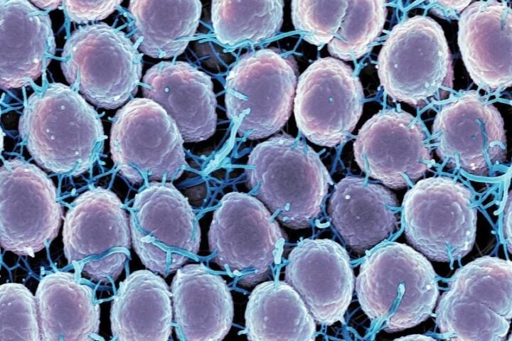 Scanning electron micrograph of Neisseria gonorrhoeae bacteria, which causes gonorrhea. Photo Source: NIAID (CC BY 2.0)