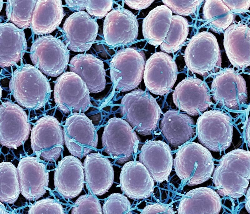 Scanning electron micrograph of Neisseria gonorrhoeae bacteria, which causes gonorrhea. Photo Source: NIAID (CC BY 2.0)