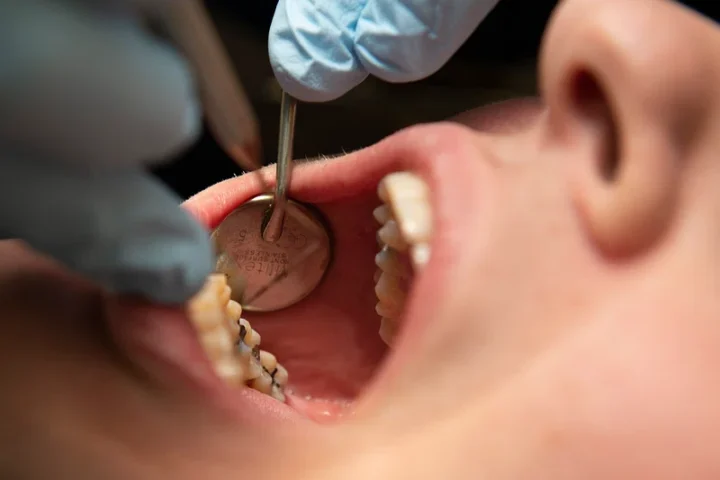 Representative image :- Dental Clinic - Photo Source :- Rawpixel.com