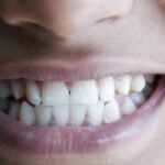 A shot of a person's teeth