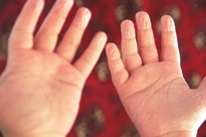 Representative image:- wrinkled finger- Photo Source :- Flicker - Photo Credit:- artfulblogger