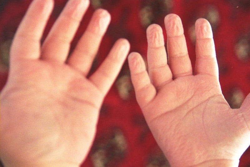Representative image:- wrinkled finger- Photo Source :- Flicker - Photo Credit:- artfulblogger