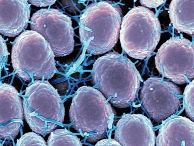 Scanning electron micrograph of Neisseria gonorrhoeae bacteria, which causes gonorrhea. Photo Source: NIAID (CC BY 2.0)