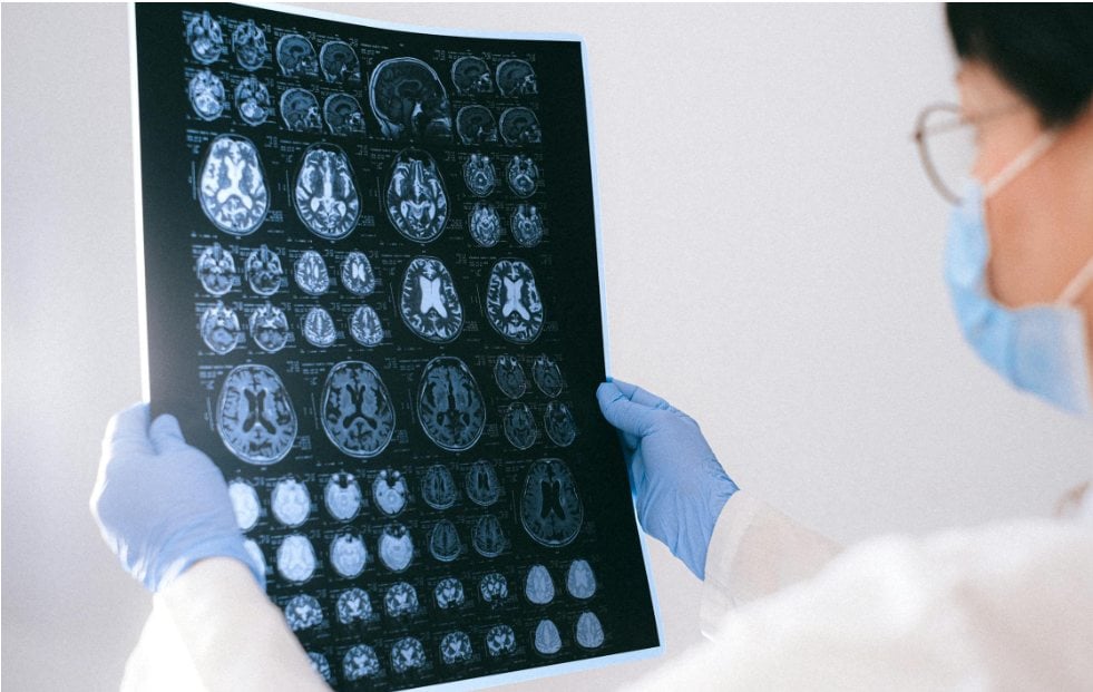 Doctor holding up an MRI Repot of brain.