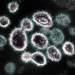 Novel Coronavirus SARS-CoV-2 Photo Source: NIH Image