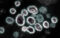 Novel Coronavirus SARS-CoV-2 Photo Source: NIH Image