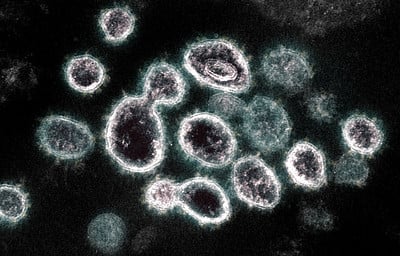 Novel Coronavirus SARS-CoV-2 Photo Source: NIH Image