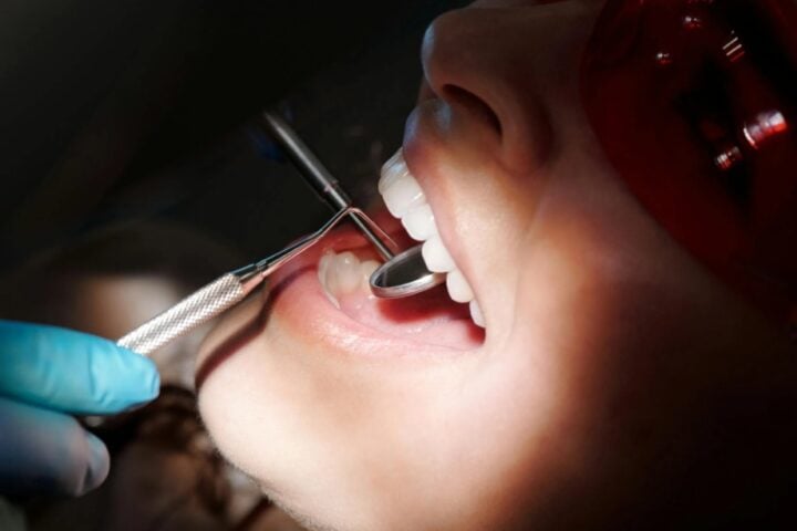 Dentist wearing gloves checking a patient’s teeth with a dental mirror in a clinical setting.