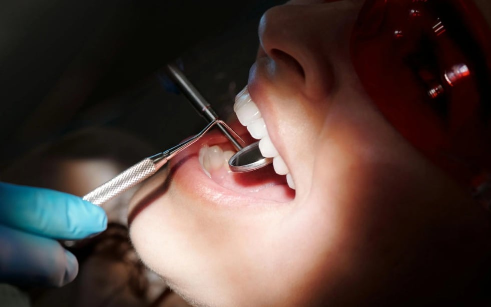 Dentist wearing gloves checking a patient’s teeth with a dental mirror in a clinical setting.