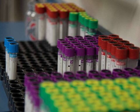 Blood Collection Tubes