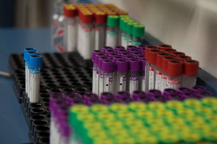 Blood Collection Tubes