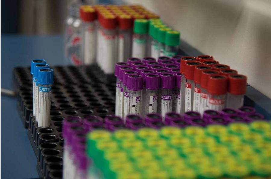 Blood Collection Tubes