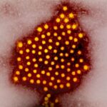 Colorized micrograph of hepatitis A virus particles. Photo Source: NIAID (CC BY 2.0)