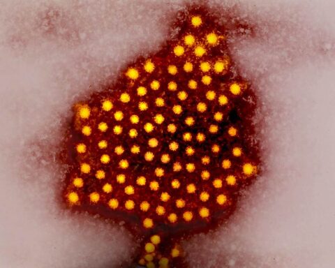 Colorized micrograph of hepatitis A virus particles. Photo Source: NIAID (CC BY 2.0)