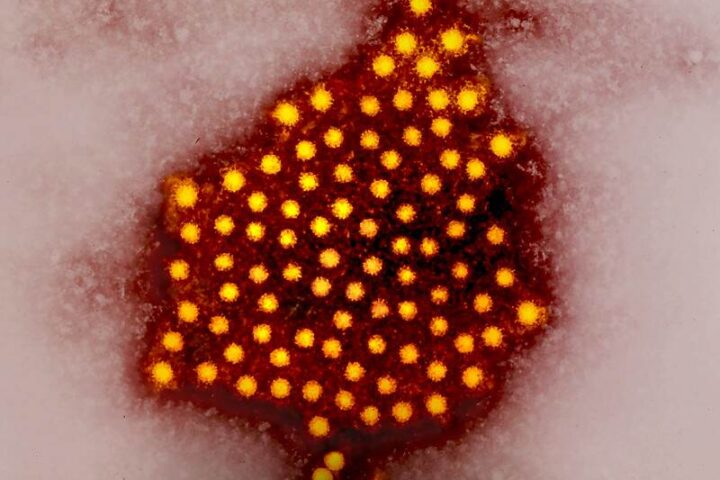 Colorized micrograph of hepatitis A virus particles. Photo Source: NIAID (CC BY 2.0)