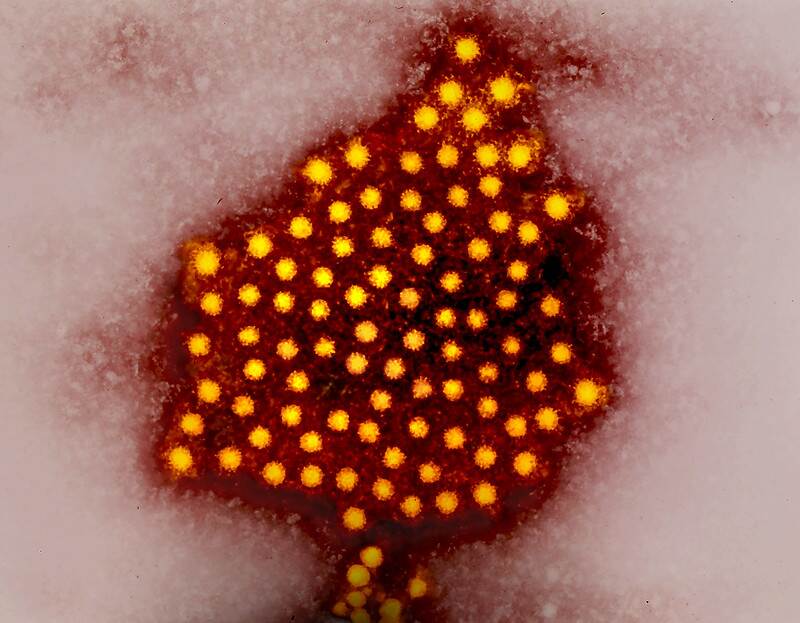 Colorized micrograph of hepatitis A virus particles. Photo Source: NIAID (CC BY 2.0)