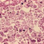 Lung tissue during legionellosis