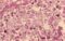 Lung tissue during legionellosis
