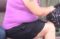 Obese woman