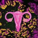 The female reproductive system as focus of this study in the background of a serous Borderline tumor. Photo Source: Lisa Schweizer, MPI of Biochemistry