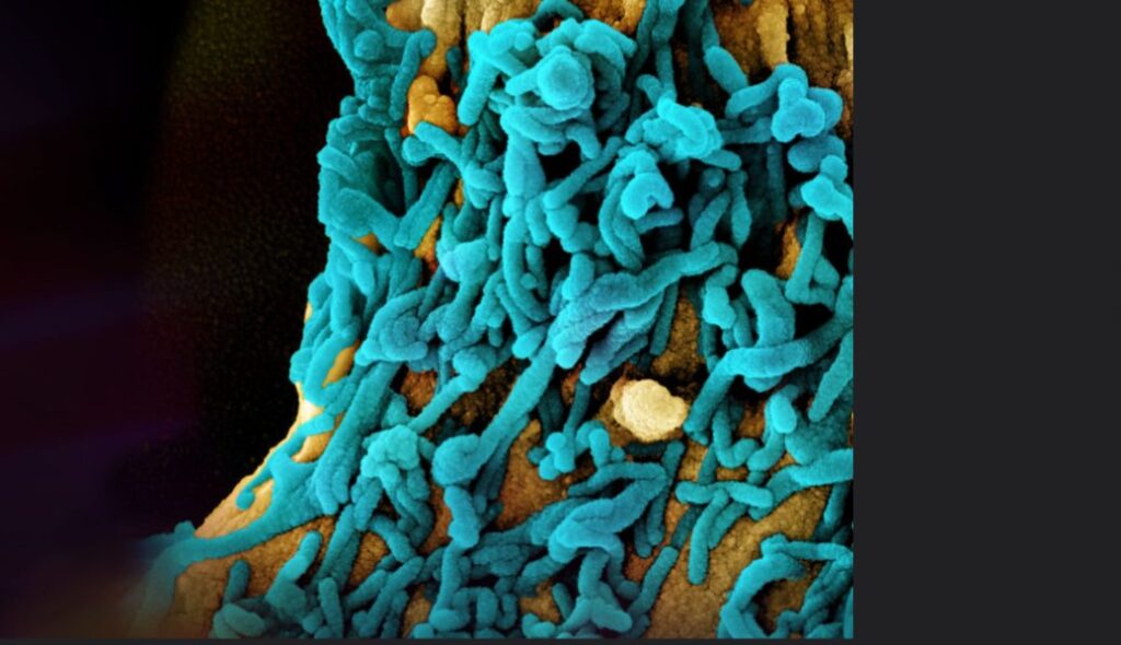 microscopic image of SARS-CoV-2 (COVID-19) virus.