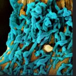microscopic image of SARS-CoV-2 (COVID-19) virus.