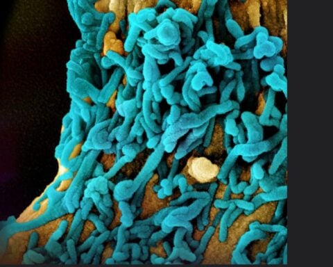 microscopic image of SARS-CoV-2 (COVID-19) virus.