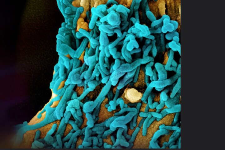 microscopic image of SARS-CoV-2 (COVID-19) virus.