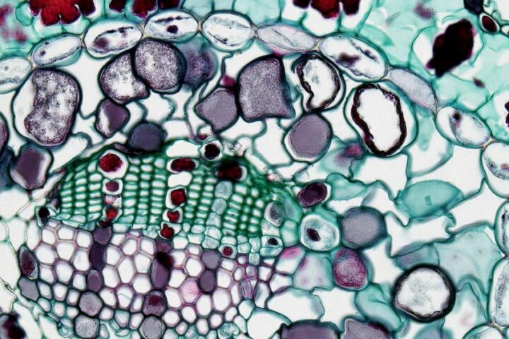 Stanford Breakthrough Single Molecule Boosts Aging Muscle Strength 15-20% in One Month.Photo Source: Fayette Reynolds M.S. Representative Image.