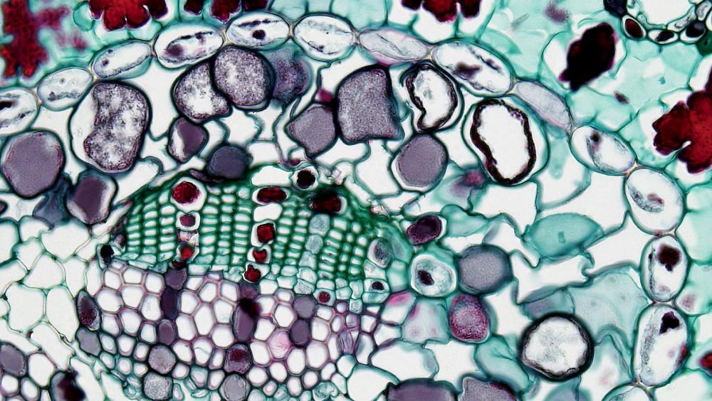 Stanford Breakthrough Single Molecule Boosts Aging Muscle Strength 15-20% in One Month.Photo Source: Fayette Reynolds M.S. Representative Image.