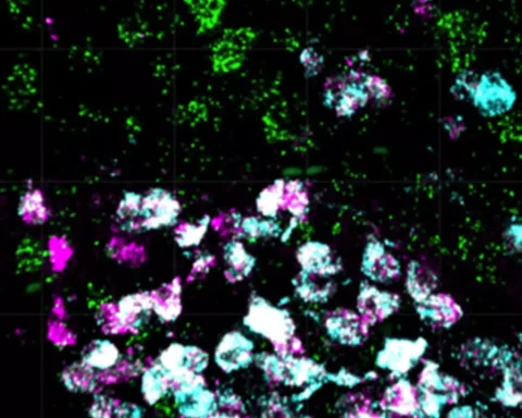 Tiny-Brain-Cell