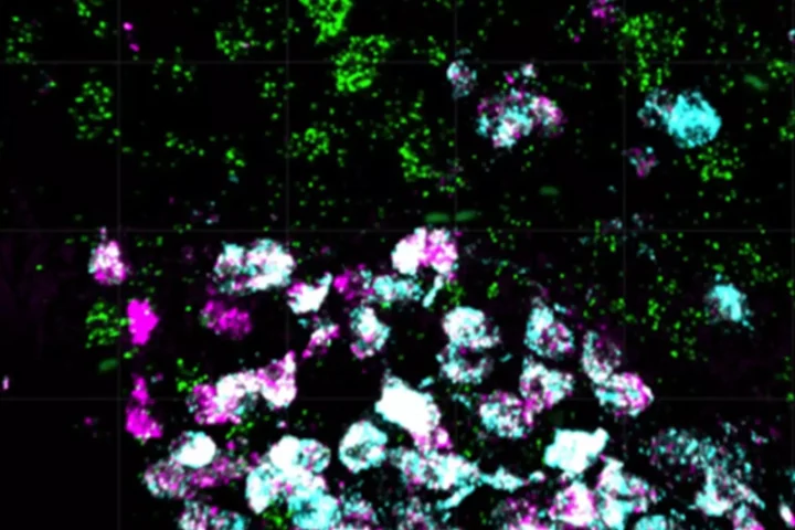 Tiny-Brain-Cell