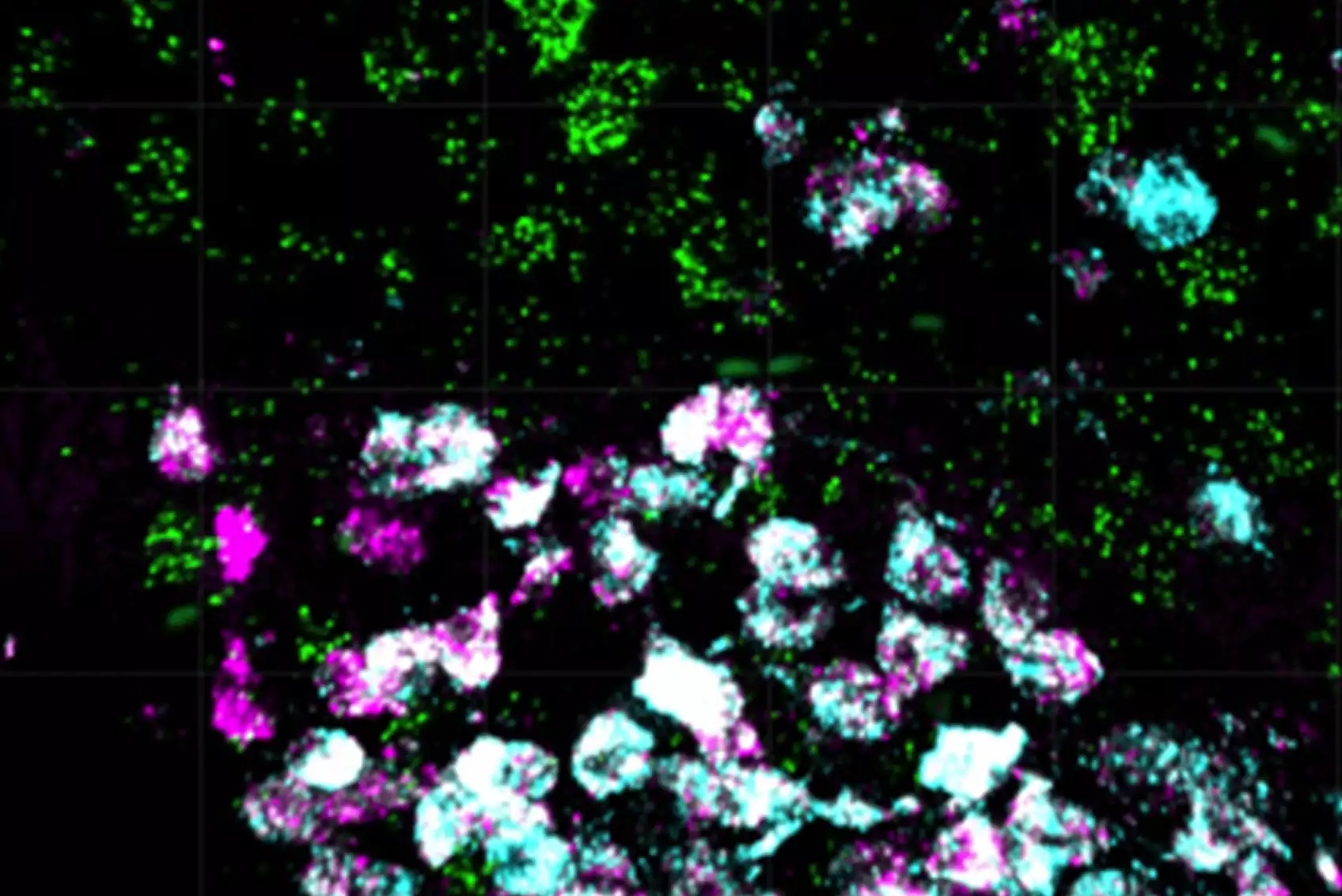 Tiny-Brain-Cell