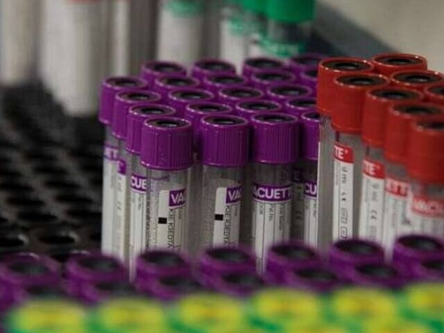 Blood Collection Tubes