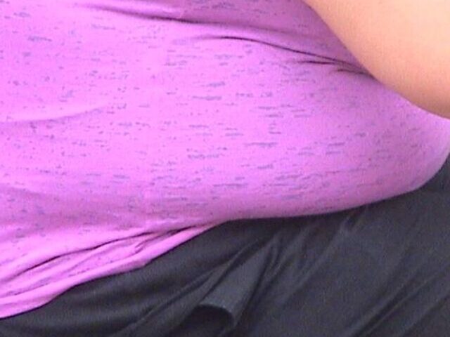 Obese woman