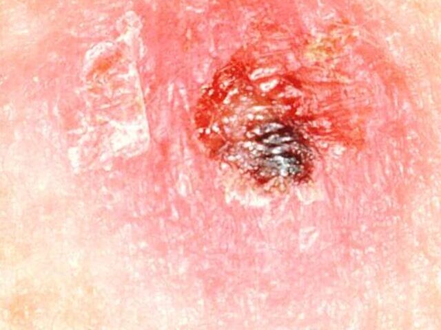 cropped-New-AI-Spots-Skin-Cancer-Before-Doctors-Can-See-It-How-PanDerm-Analyzes-Multiple-Image-Types.jpg